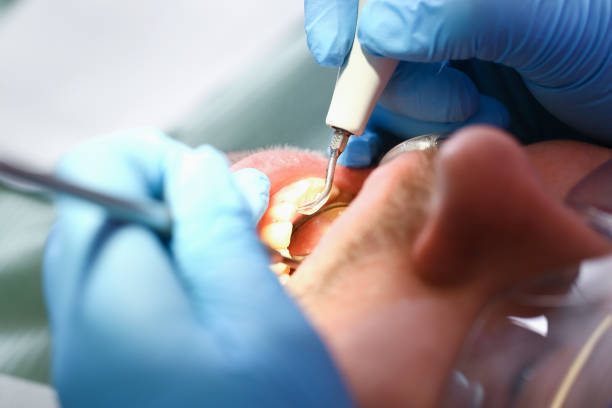 Best Dentist for Dental Trauma  in Pleasant Ridge, MI